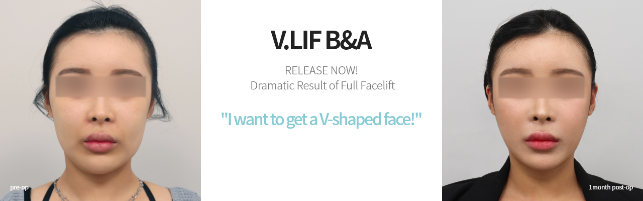 V.LIF B&A  빌리프를 경험한 분들의 드라마틱한 리프팅 효과를 지금 공개합니다! V라인되고싶어요!