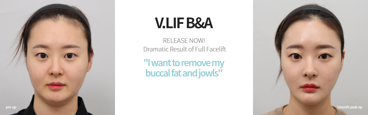 V.LIF B&A  빌리프를 경험한 분들의 드라마틱한 리프팅 효과를 지금 공개합니다! 볼살, 턱살 없애고싶어요
