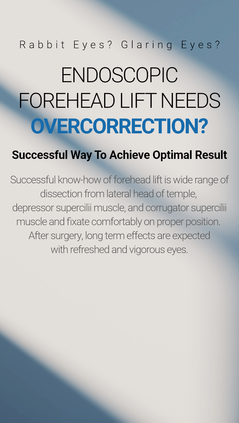 Rabbit Eyes? Glaring Eyes? ENDOSCOPIC FOREHEAD LIFT NEEDS OVERCORRECTION? Successful Way To Achieve Optimal Result Successful know-how of forehead lift is wide range of dissection from lateral head of temple, depressor supercilii muscle, and corrugator supercilii muscle and fixate comfortably on proper position. After surgery, long term effects are expected with refreshed and vigorous eyes.