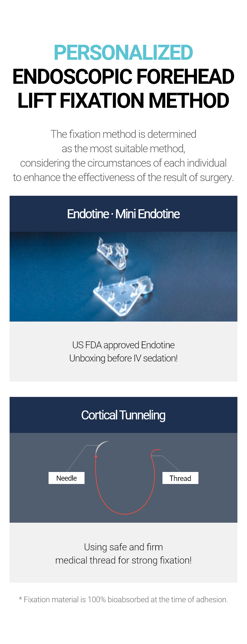 PERSONALIZED ENDOSCOPIC FOREHEAD LIFT FIXATION METHOD The fixation method is determined as the most suitable method, considering the circumstances of each individual to enhance the effectiveness of the result of surgery. Endotine · Mini Endotine - US FDA approved Endotine Unboxing before IV sedation!, Cortical Tunneling - Using safe and firm medical thread for strong fixation!