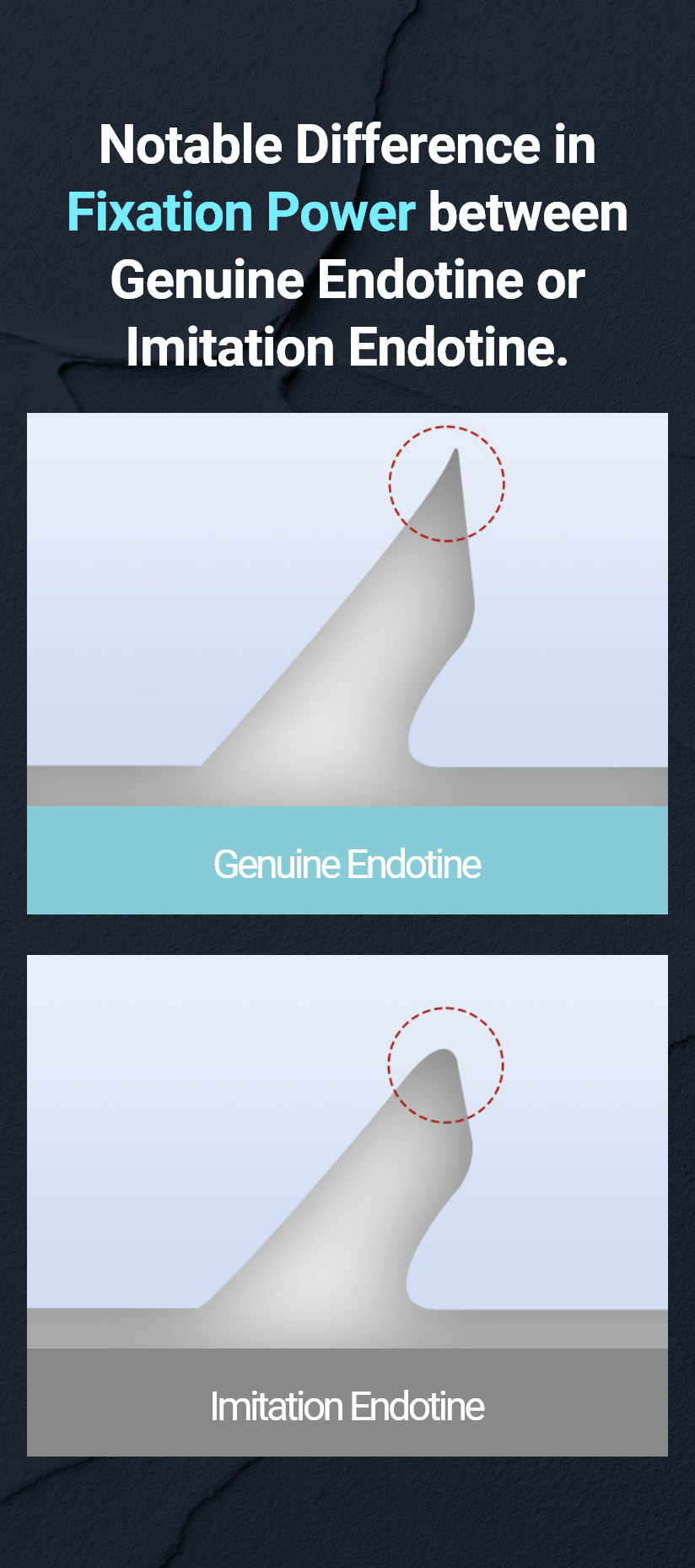 Notable Difference in Fixation Power between Genuine Endotine or Imitation Endotine. Genuine Endotine, Endotine