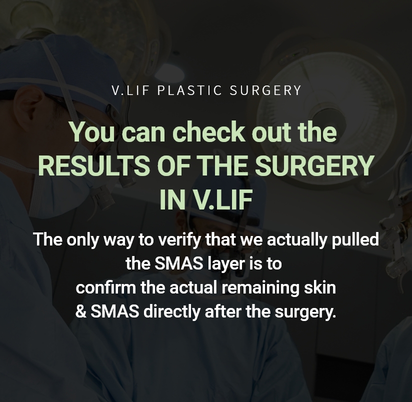  V.LIF PLASTIC SURGERY 수술결과를 확인 할 수 있는 빌리프 스마스층을 실제로 당겼는지 확인 할 수 있는 유일한 방법은 수술 후 당기고 남은 스마스 및 피부를 삭제한 것을 확인하는 것입니다. 실제로 리프팅 시술 후 확인까지 할 수 있는 병원은 오직 빌리프 뿐입니다. 보다 확실한 방법으로 올바른 리프팅을 선도하겠습니다.