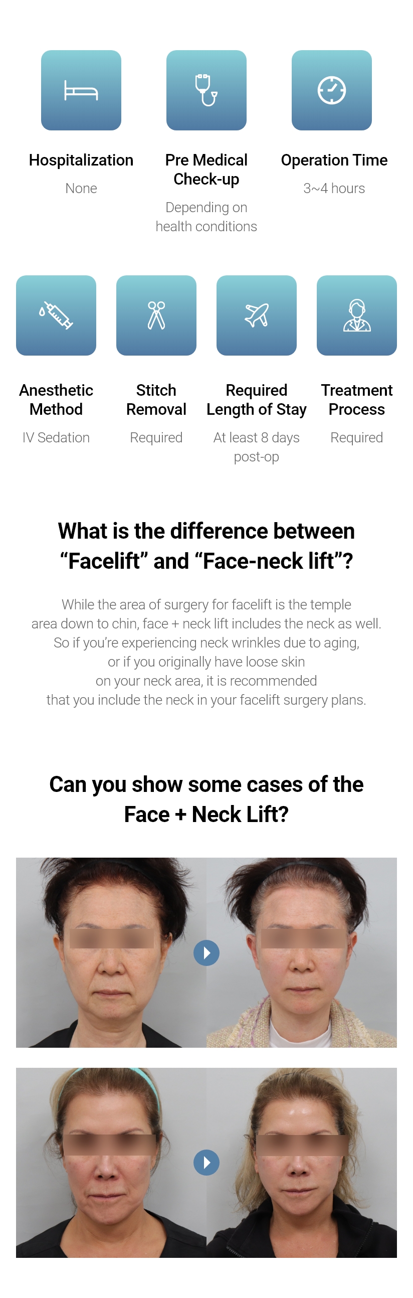 Hospitalization None, Anesthetic Method Depending on health conditions, Operation Time 1~2 hours, Anesthetic Method IV Sedation, Stitch Removal Required, Required Length of Stay At least 7 days post-op, Treatment Process Required, What is the difference between “Facelift” and “Face-neck lift”? While the area of surgery for facelift is the temple area down to chin, face + neck lift includes the neck as well. So if you’re experiencing neck wrinkles due to aging,or if you originally have loose skin on your neck area, it is recommended that you include the neck in your facelift surgery plans. Can you show some cases of the Face + Neck Lift?