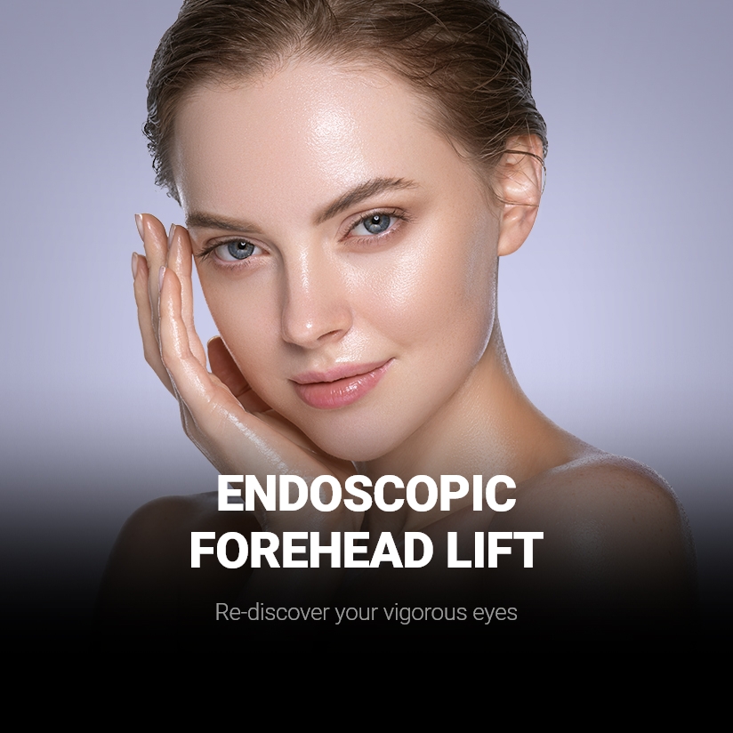 ENDOSCOPIC FOREHEAD LIFT Re-discover your vigorous eyes